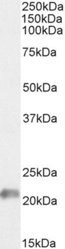Anti-JWA Antibody, 100 µg