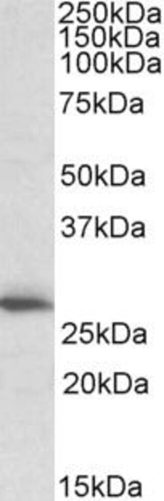 Anti-CLPP Antibody