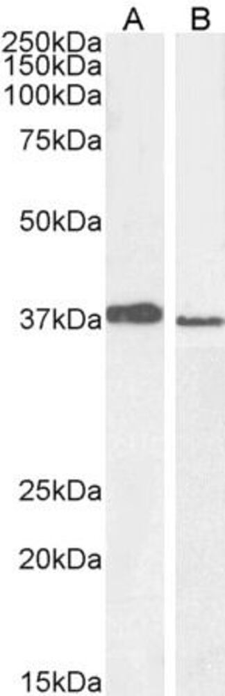 Anti-Mel18 Antibody