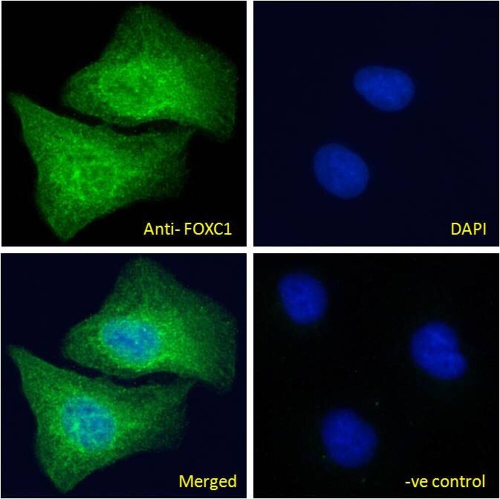 Anti-FOXC1 Antibody, 100 µg