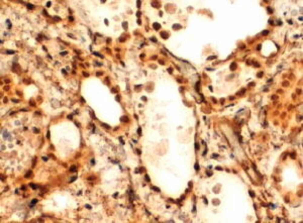 Anti-TTF2 Antibody, 100 µg