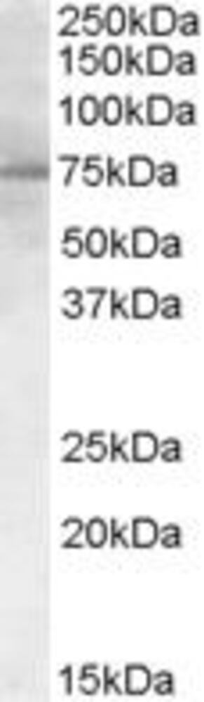 Anti-PCSK9 Antibody
