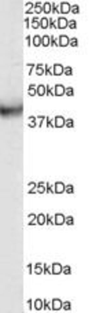 Anti-VPS37C Antibody, 100 µg