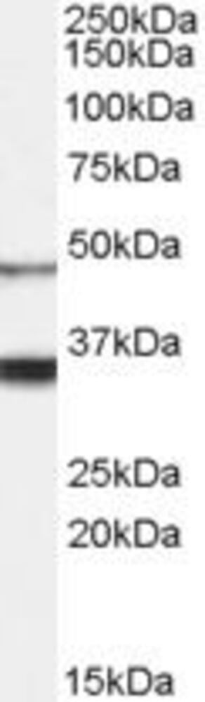Anti-Orexin Receptor 1 Antibody, 100 µg