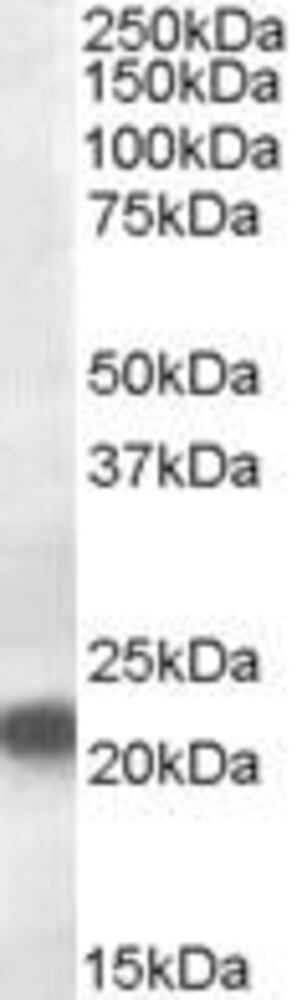 Anti-VPS25 Antibody, 100 µg
