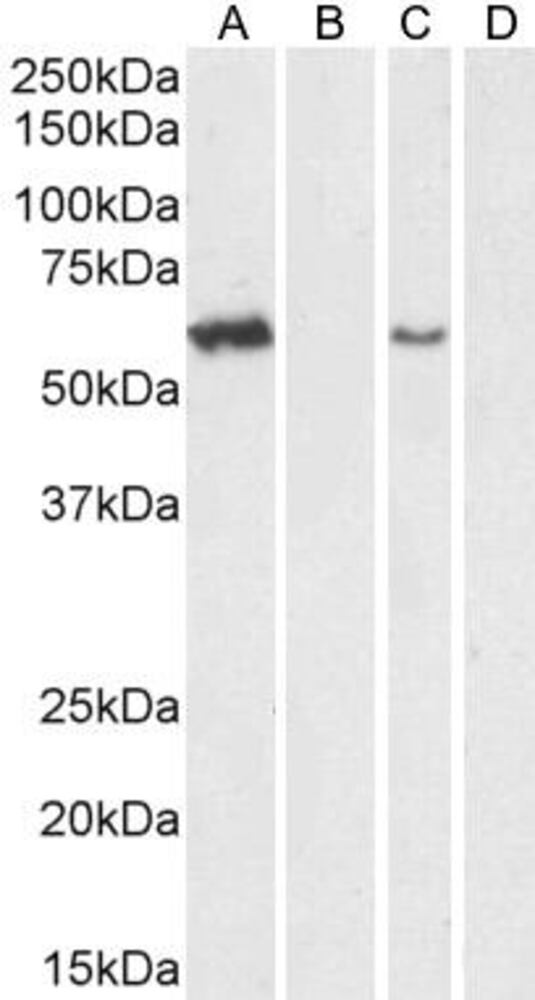 Anti-ARSA/ASA Antibody