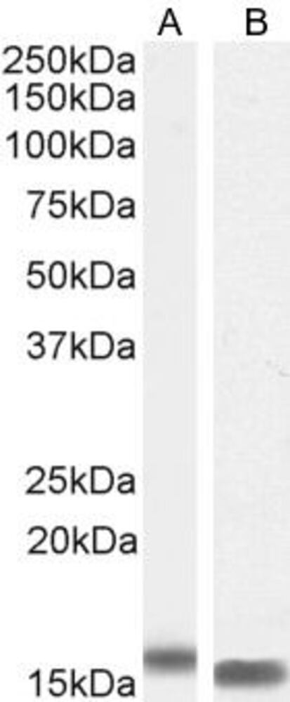 Anti-I-FABP Antibody