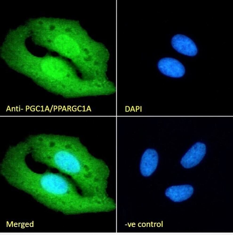 Anti-PGC1 alpha Antibody, 100 µg