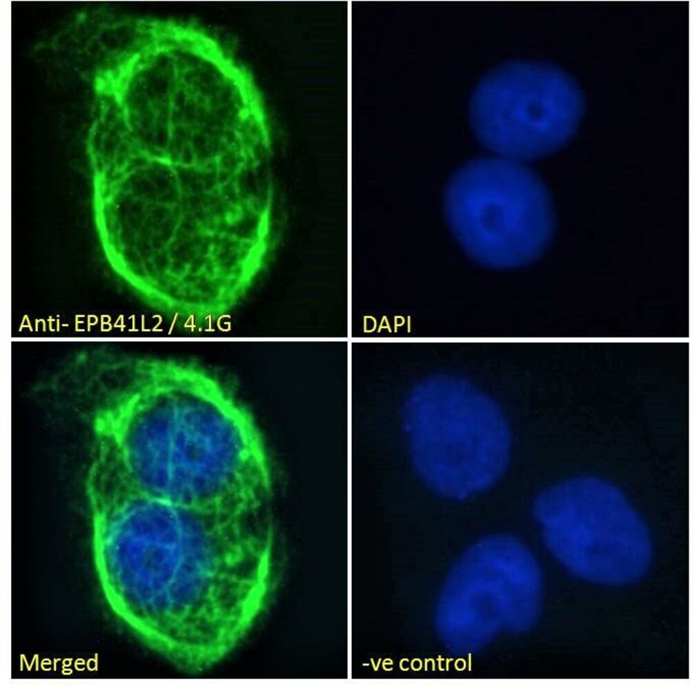 Anti-EPB41L2 Antibody, 100 µg