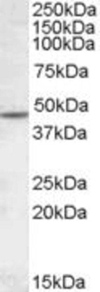 Anti-CHRNA2 Antibody, 100 µg