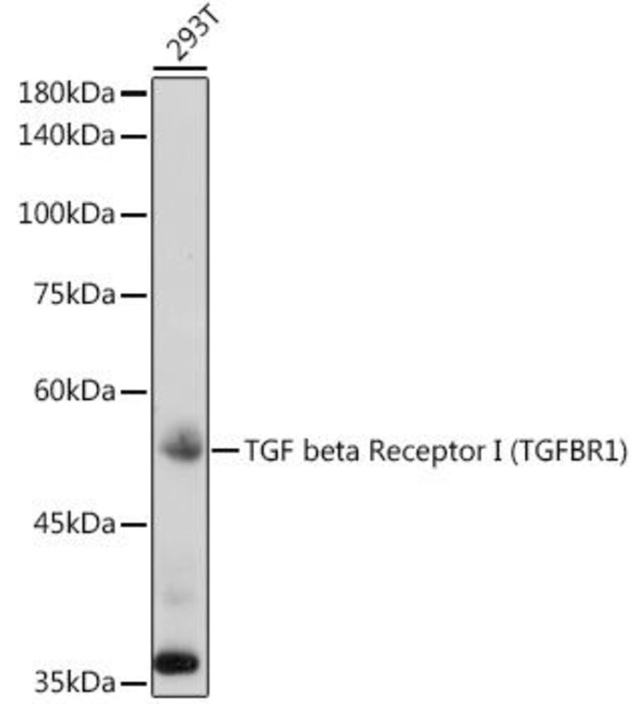 Anti-TGF beta Receptor I Antibody, 100 µl