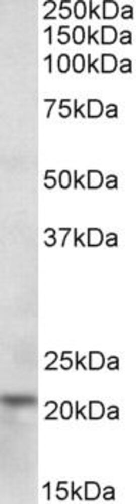 Anti-Ferritin Heavy Chain Antibody, 100 µg