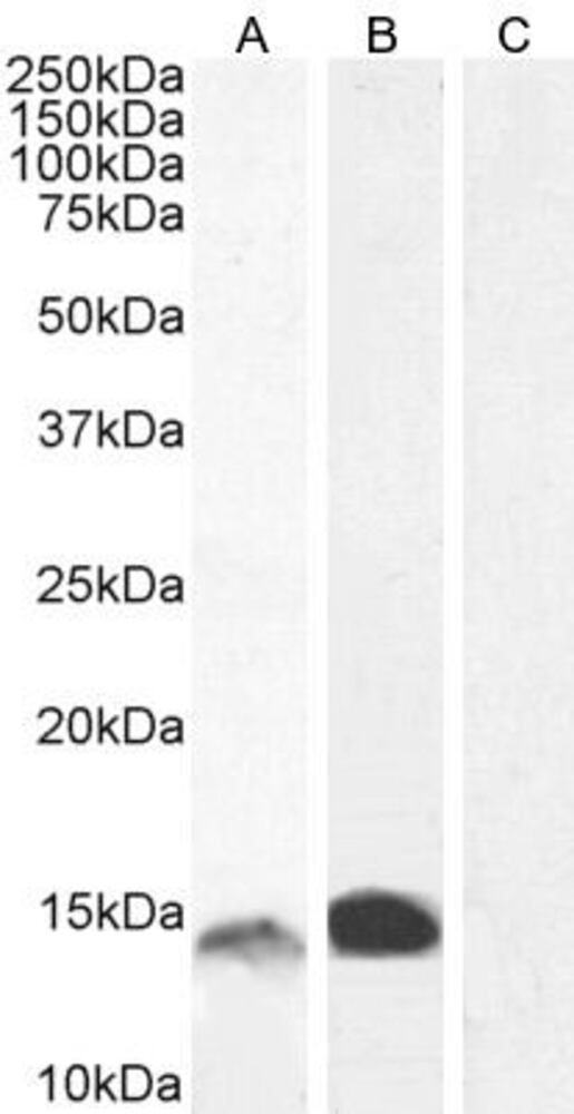 Anti-S100A9 Antibody