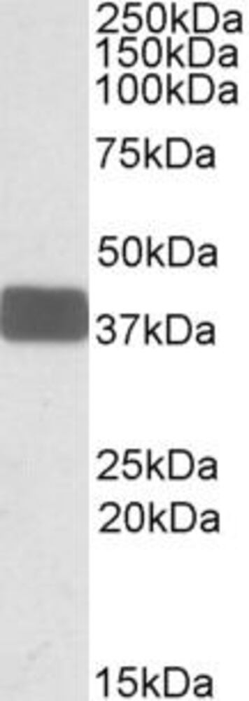 Anti-Wnt9b Antibody, 100 µg