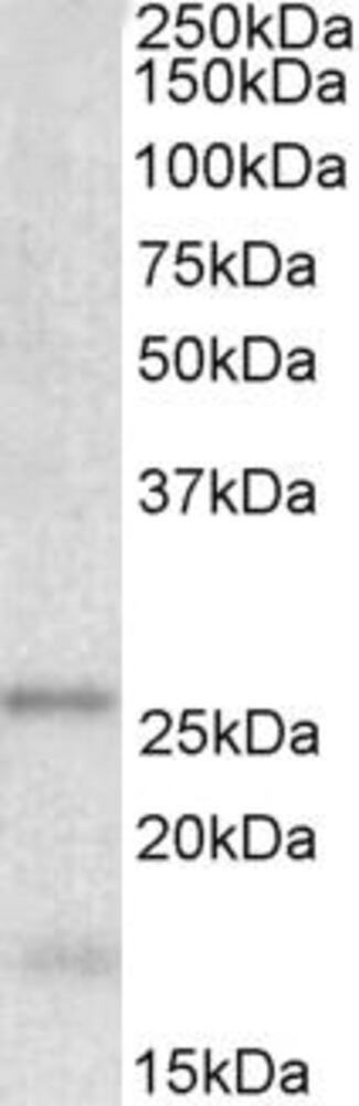 Anti-TPPP Antibody, 100 µg