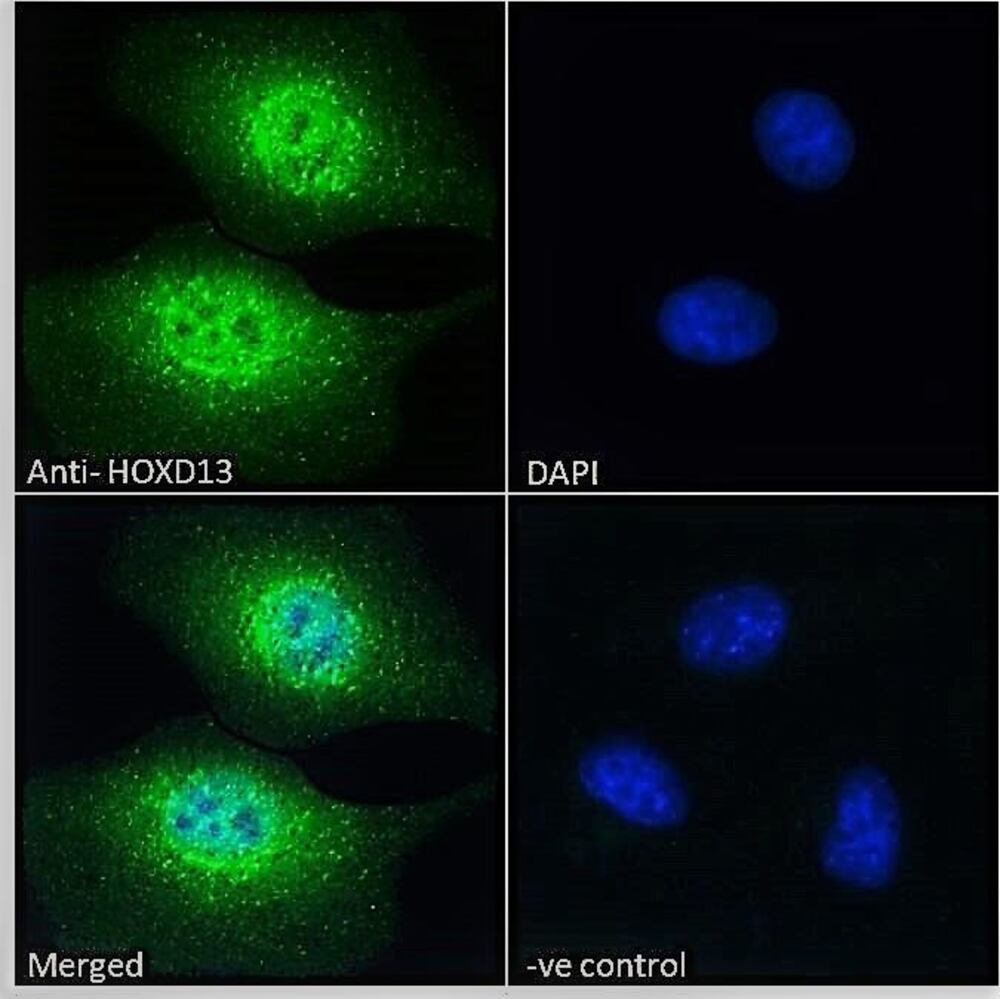 Anti-HOXD13 Antibody, 100 µg