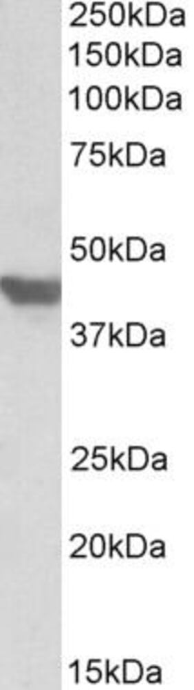 Anti-Glucose Transporter GLUT4 Antibody, 100 µg