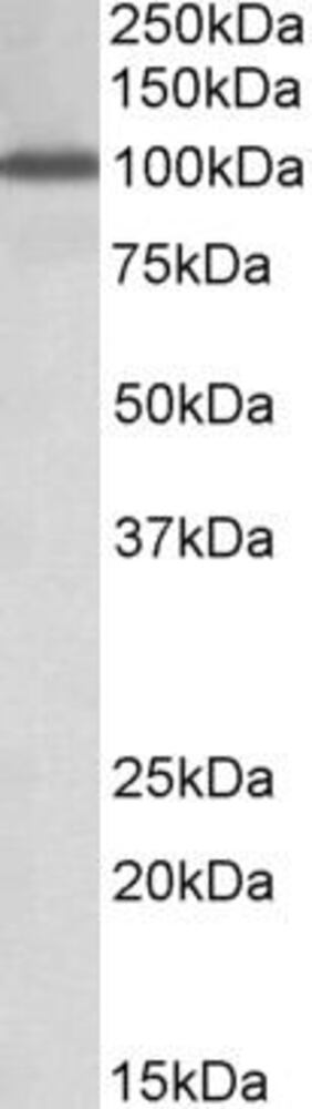 Anti-Nup107 Antibody
