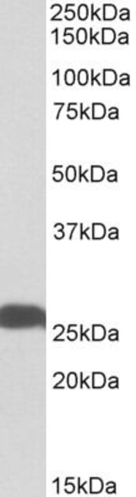 Anti-PGP9.5 Antibody