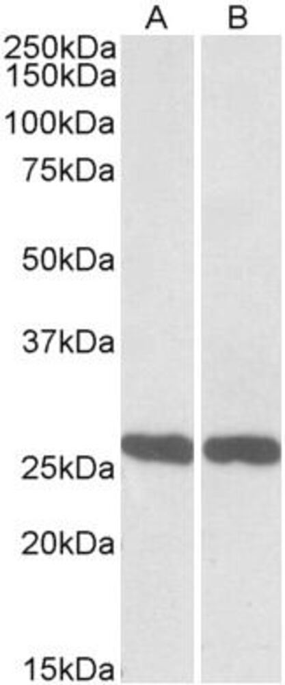 Anti-PGP9.5 Antibody