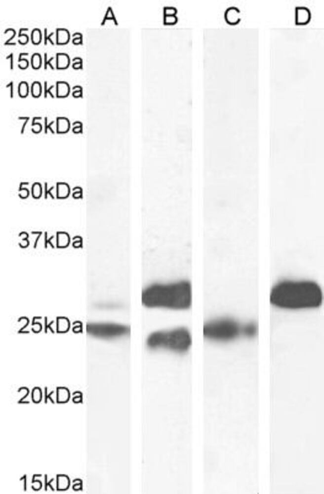 Anti-Cardiac Troponin I Antibody, 100 µg