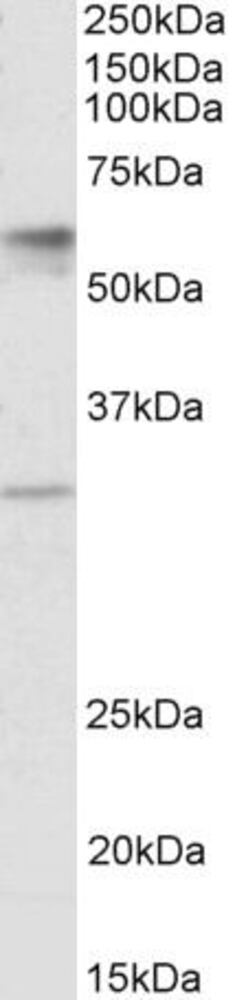 Anti-SLC17A5 Antibody, 100 µg