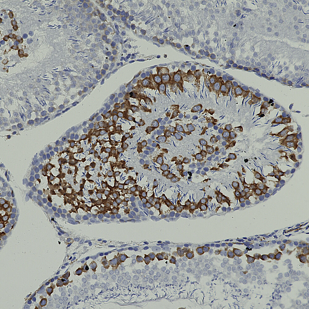Anti-Nestin Antibody [4D11]