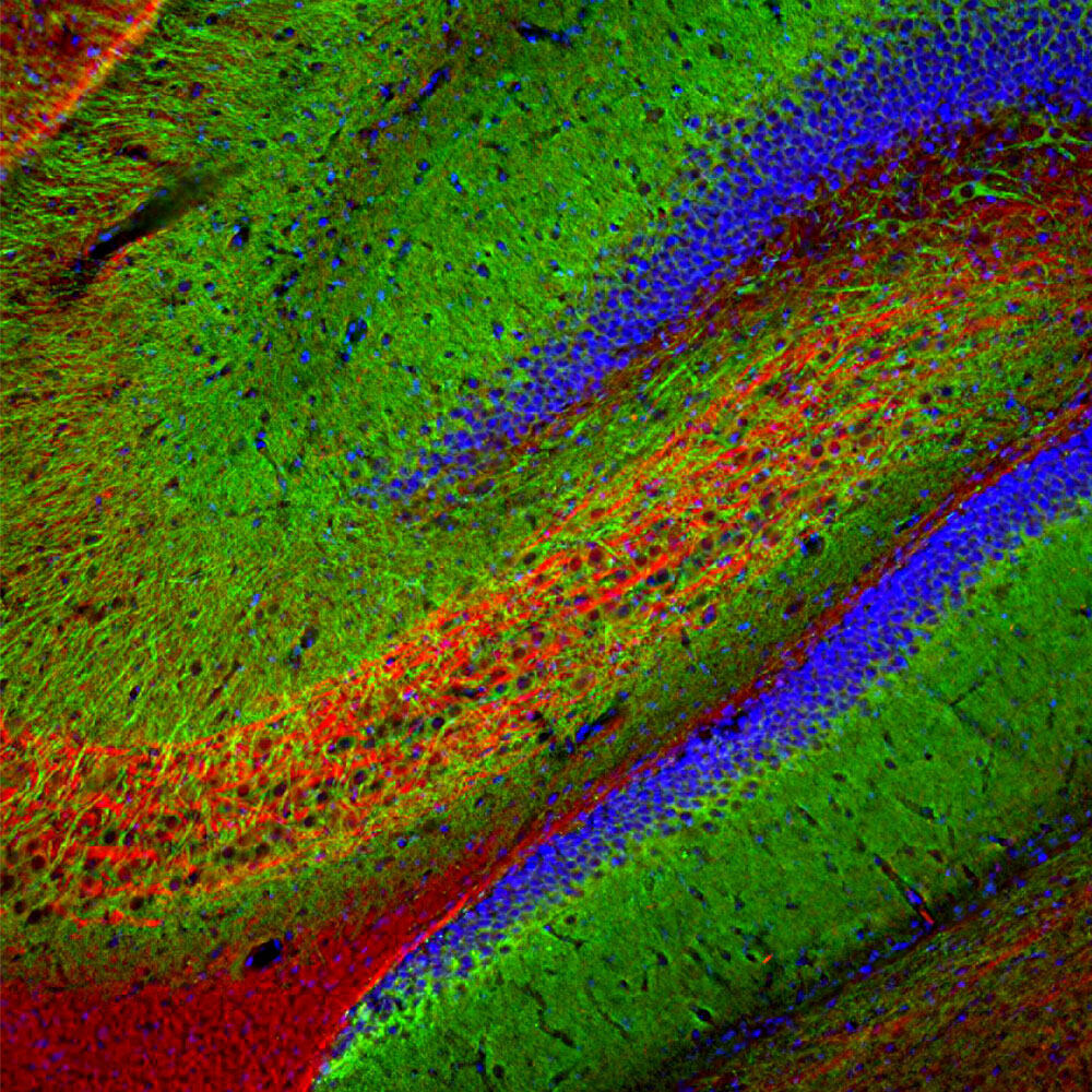 Anti-MAP2 Antibody [5H11]