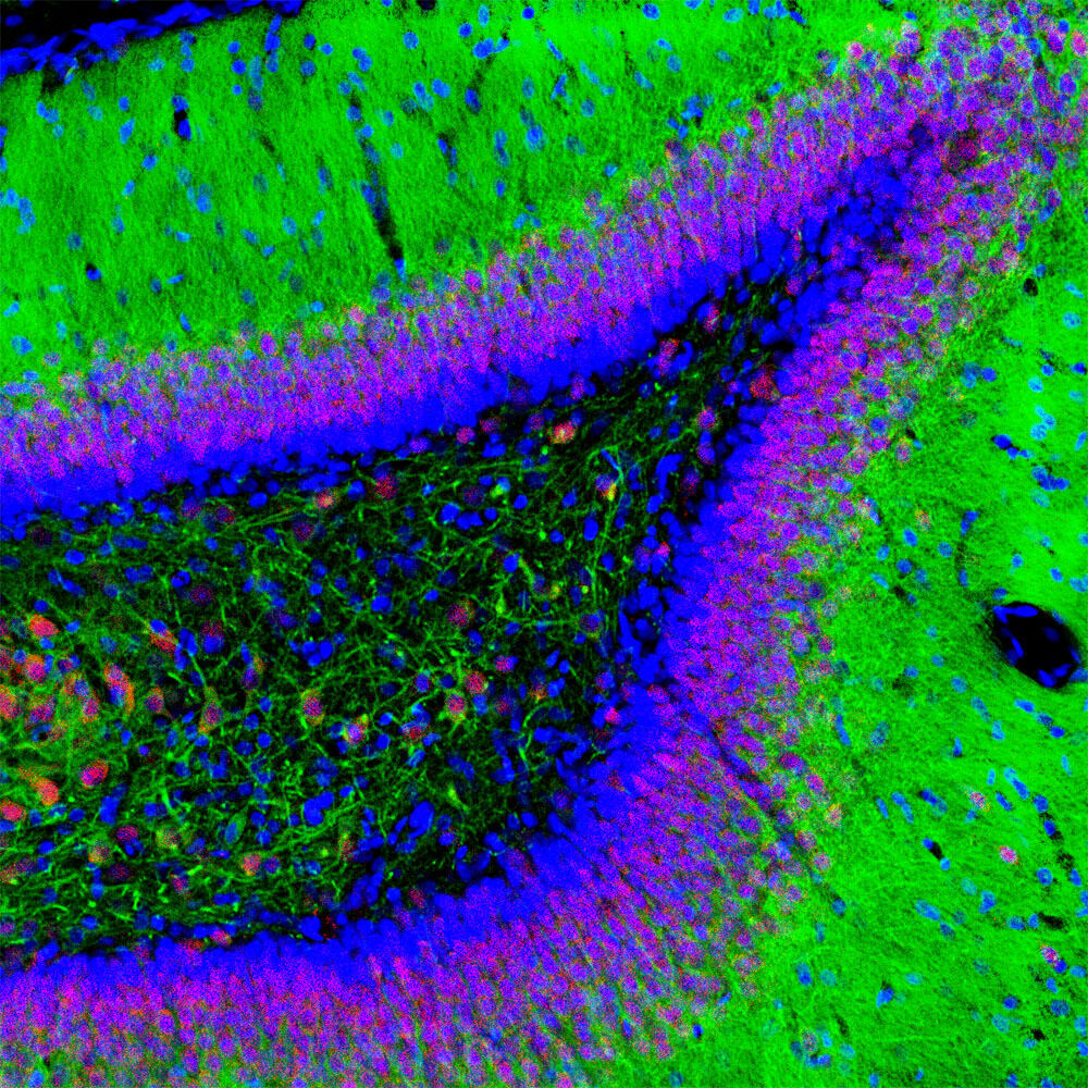 Anti-MAP2 Antibody [4H5]