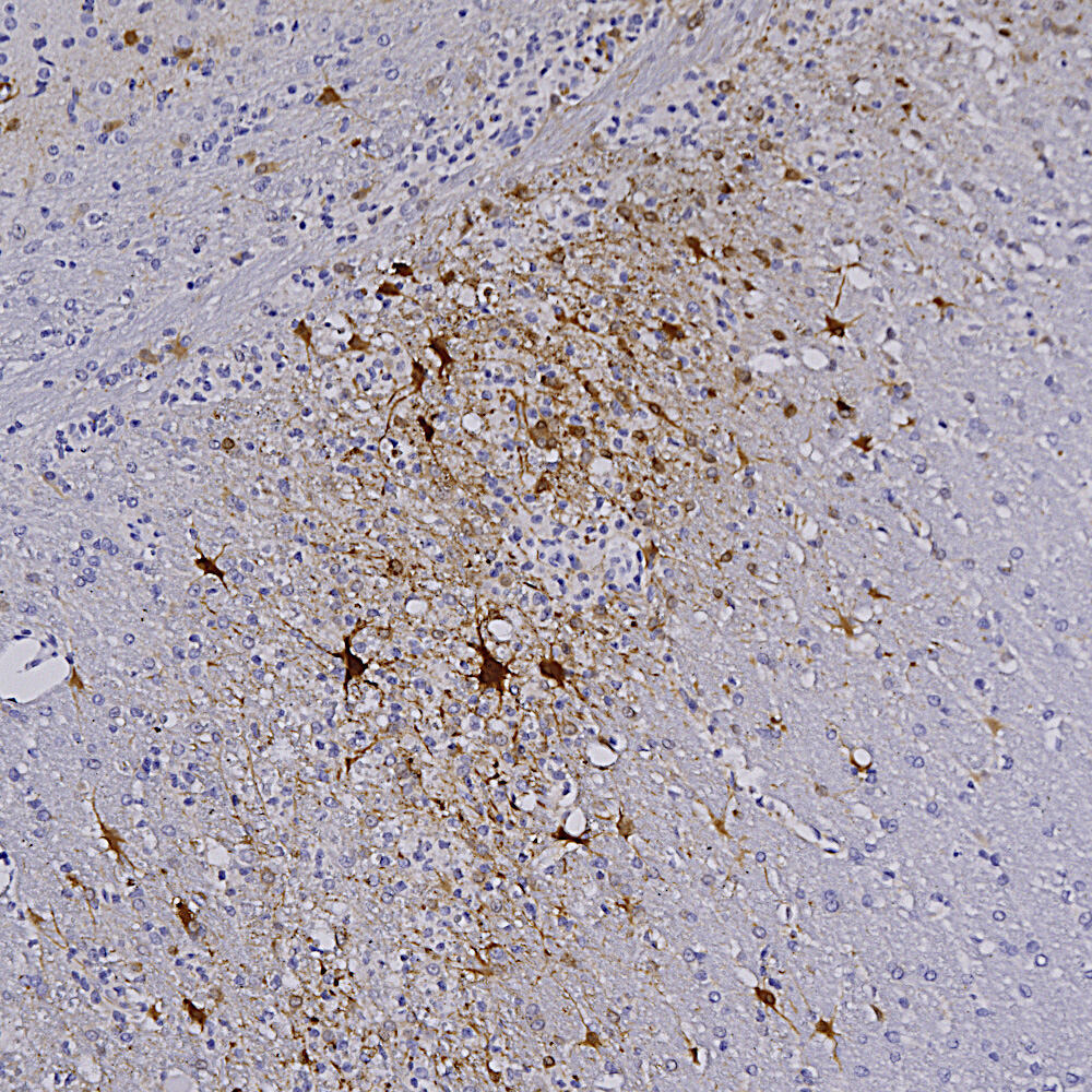 Anti-mCherry Antibody [1C51]