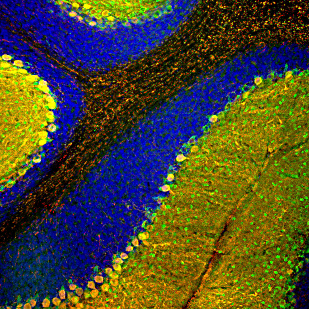 Anti-Parvalbumin Antibody [3C9]