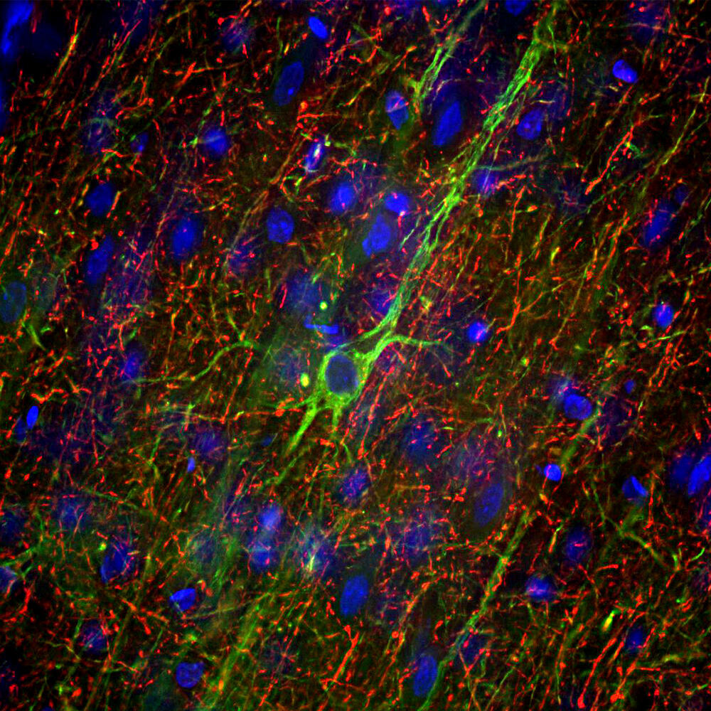 Anti-NF-M Antibody [3H11]