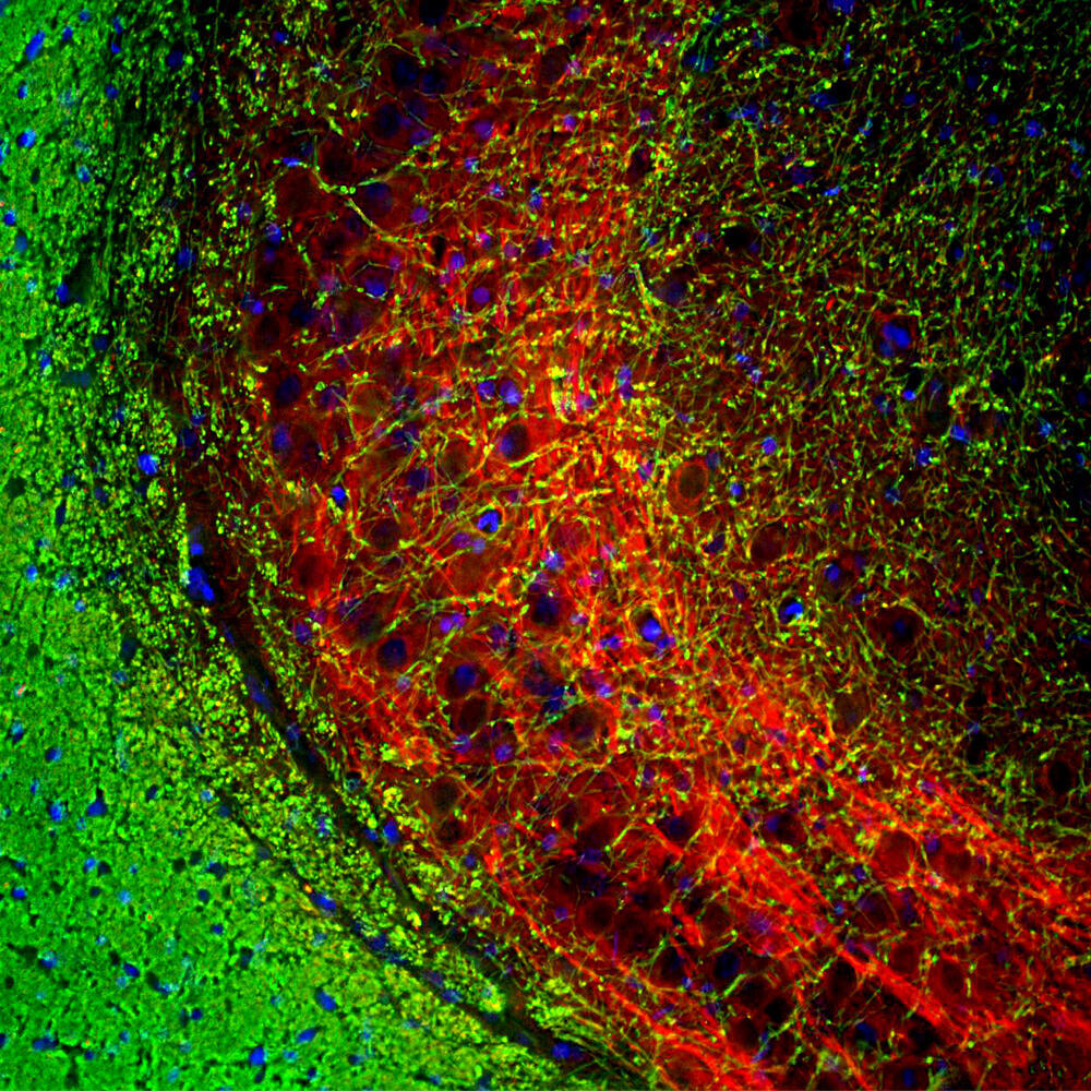 Anti-Myelin Basic Protein Antibody [7D2]