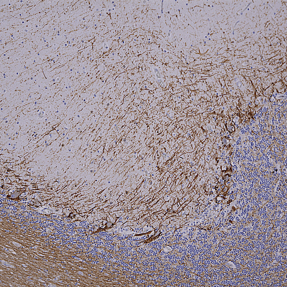Anti-NF-H Antibody [NAP4]