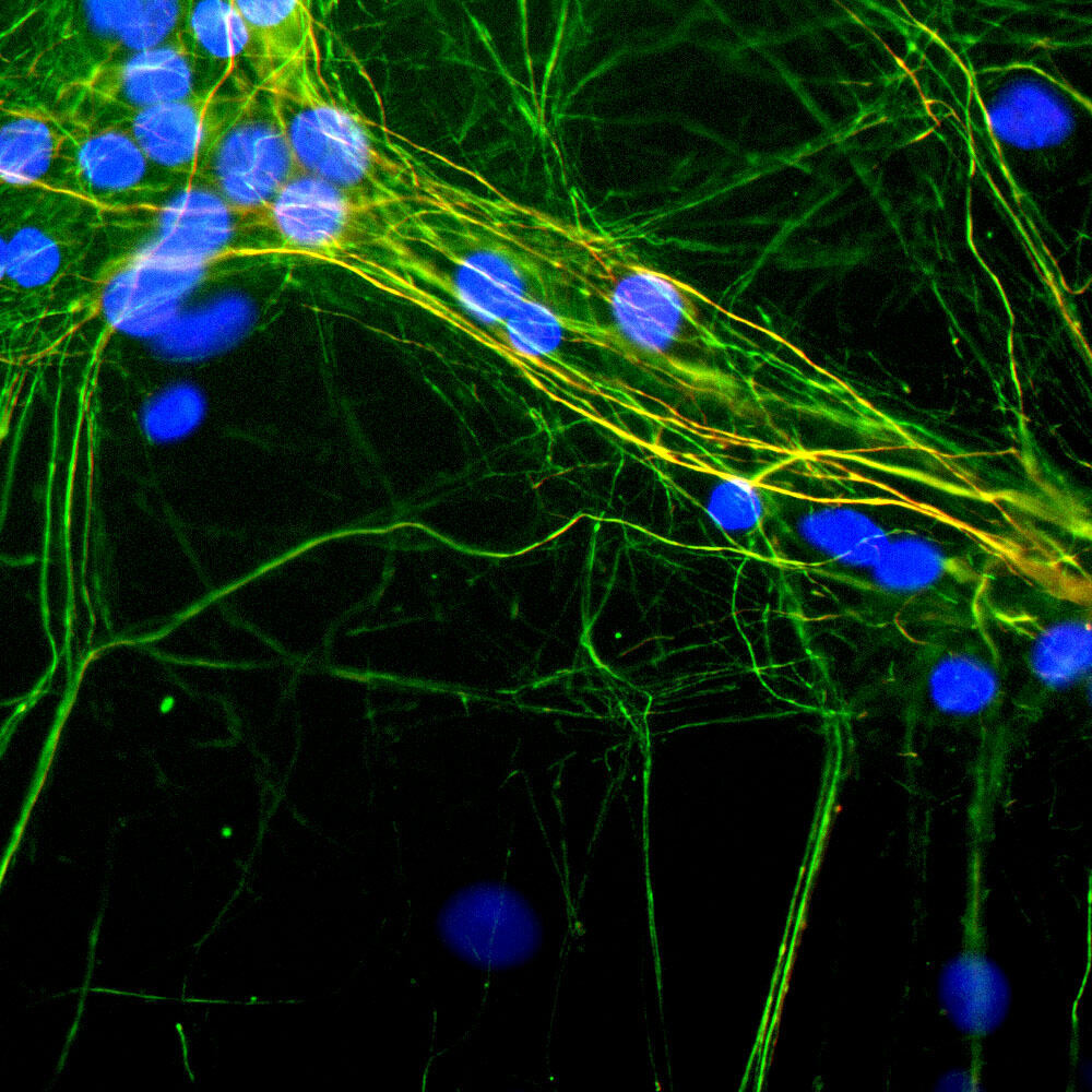 Anti-NF-H Antibody [9B12]