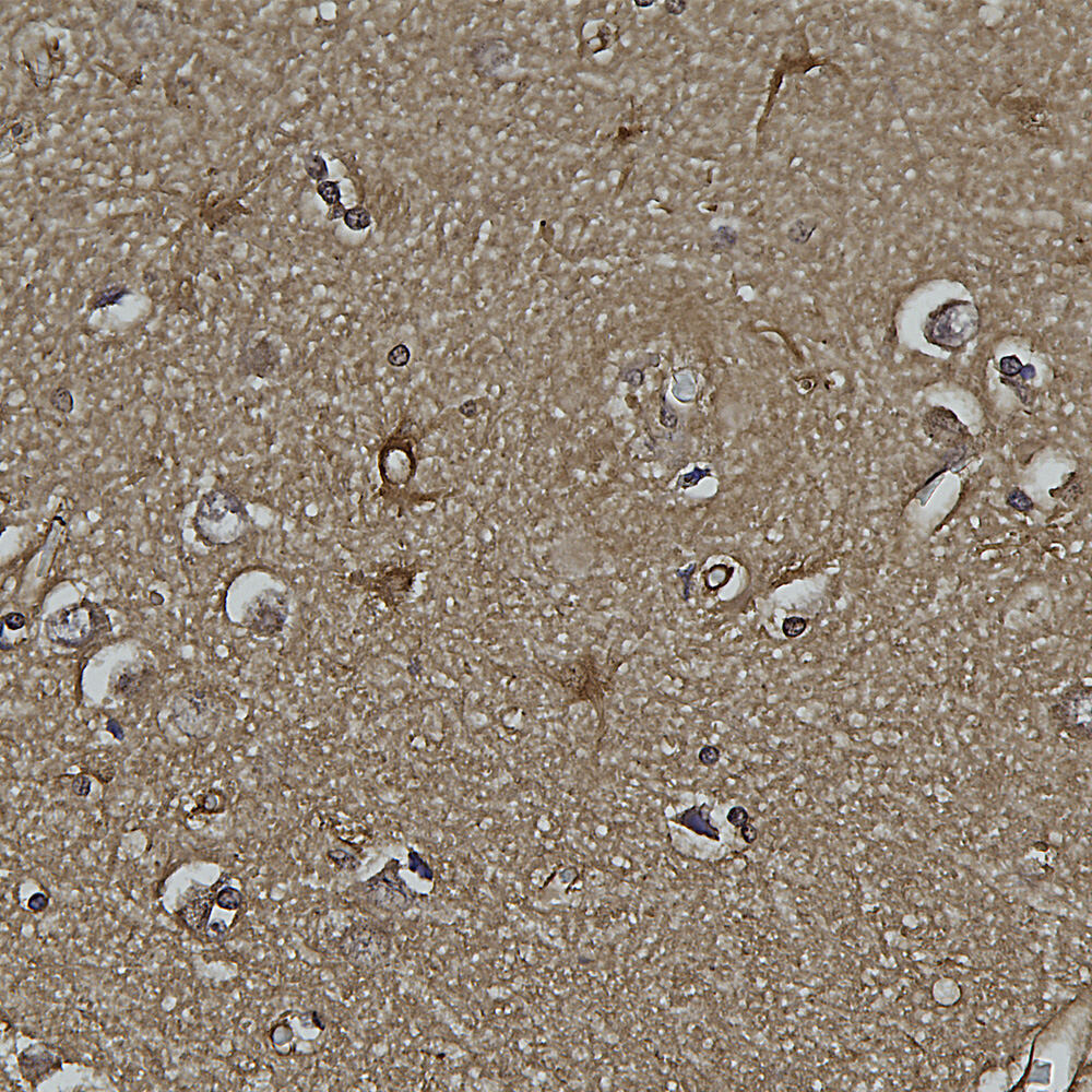 Anti-DJ1 Antibody [4H4]