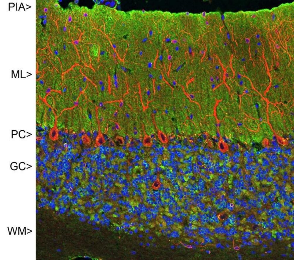 Anti-Visinin Like Protein 1 Antibody [2D, 11]