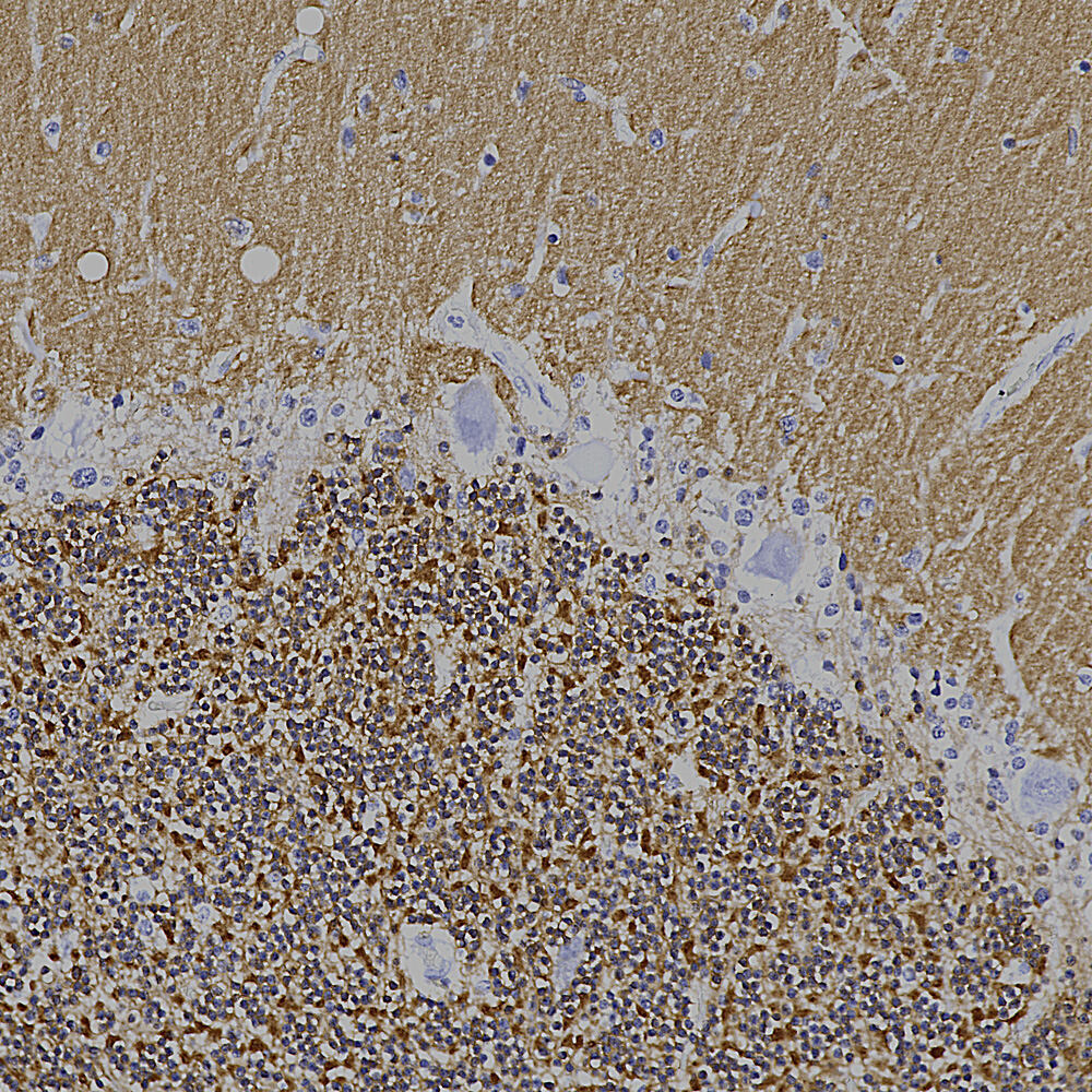 Anti-Visinin Like Protein 1 Antibody [3A, 9], 100 µl