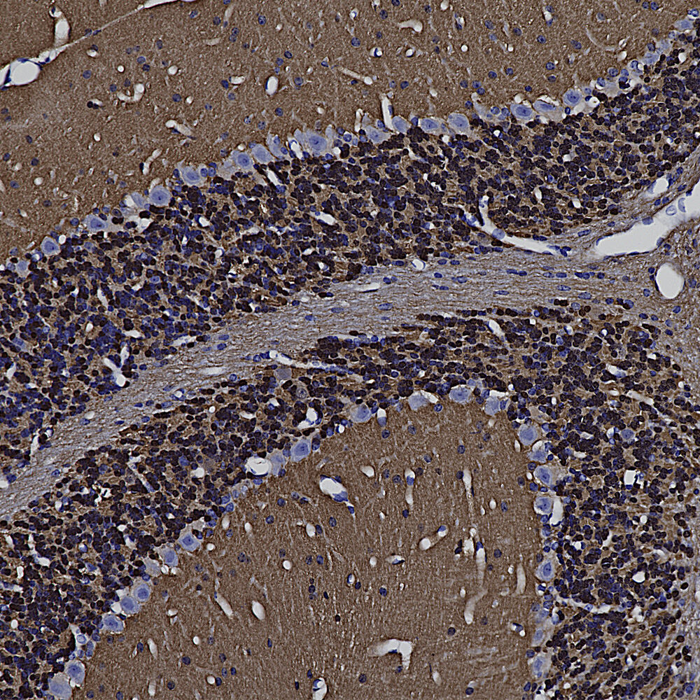 Anti-Visinin Like Protein 1 Antibody, 100 µl
