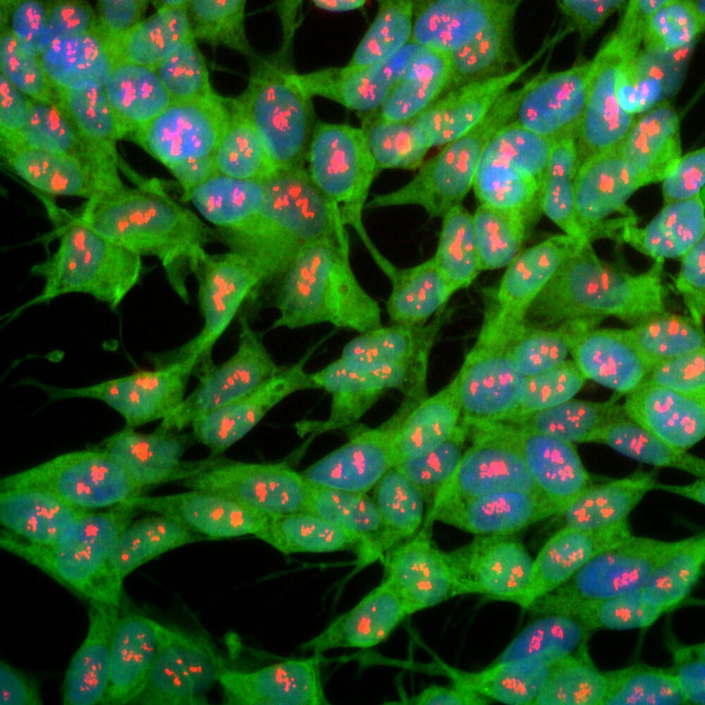 Anti-UCHL1 Antibody