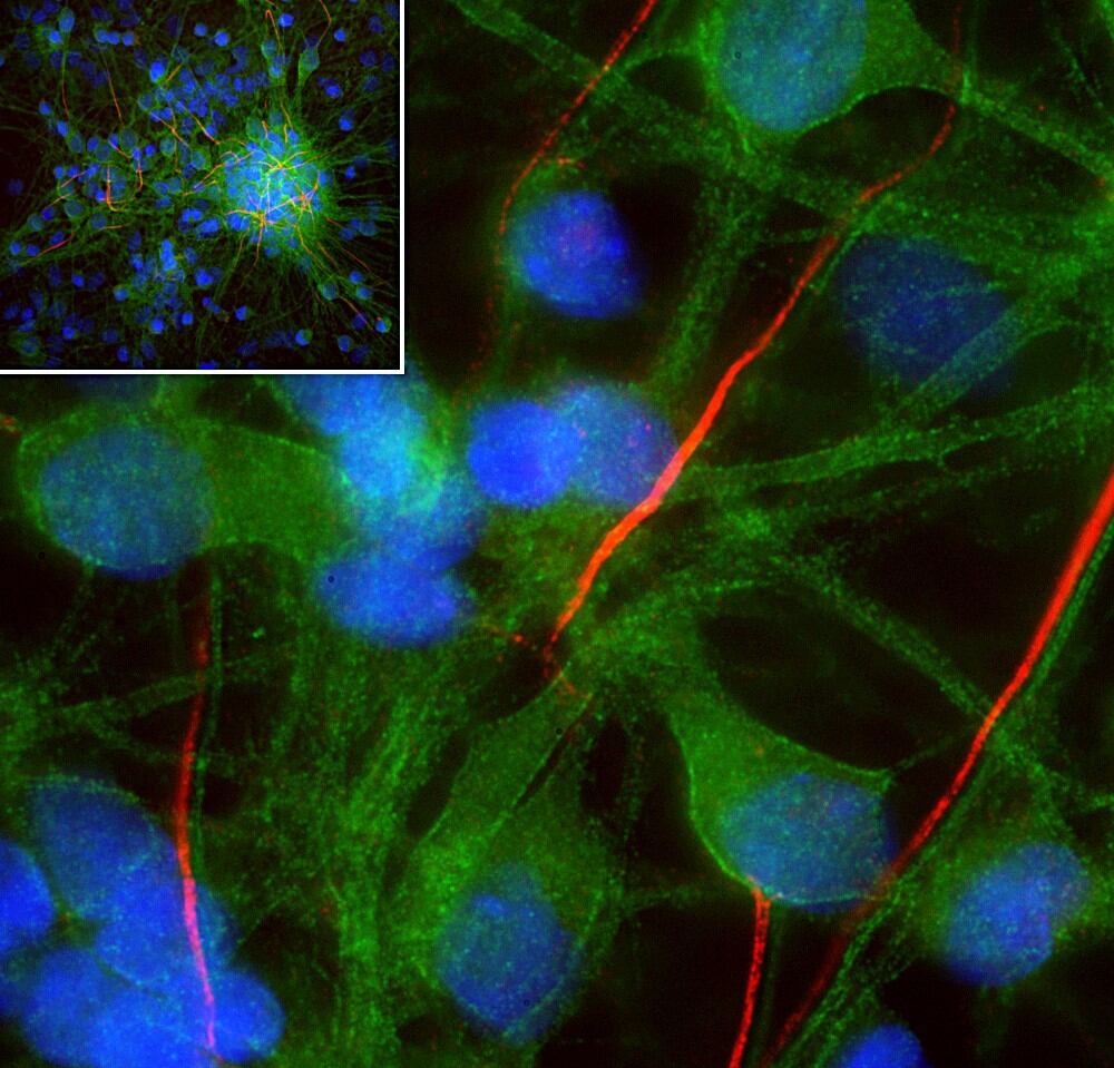 Anti-alpha II Spectrin Antibody