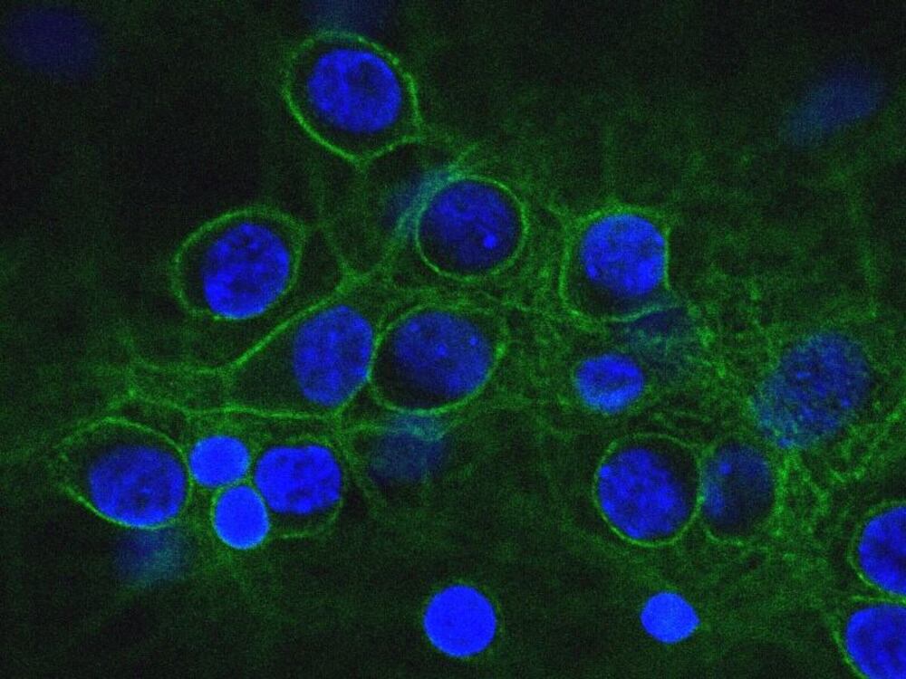 Anti-alpha II Spectrin Antibody [3D7]