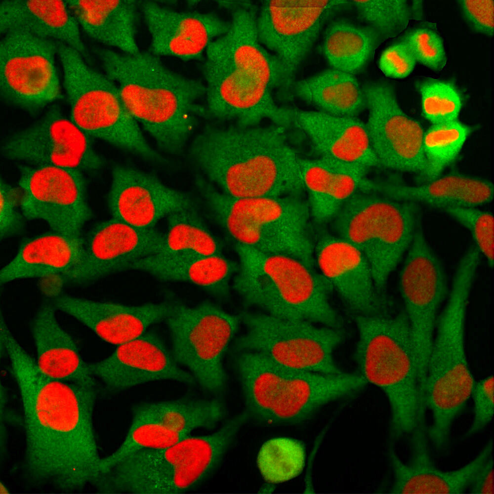 Anti-HMGB1 Antibody [1F3]
