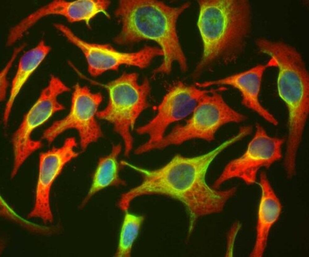 Anti-HSP27 Antibody [6H11]