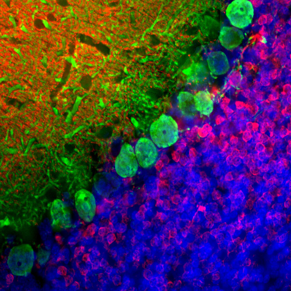 Anti-Calbindin Antibody [4H7]