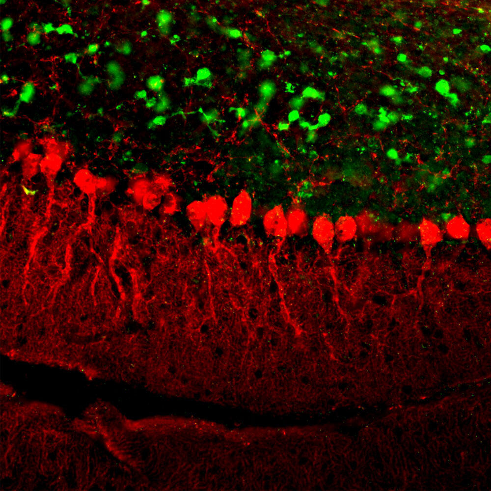 Anti-Calretinin Antibody [3G9]