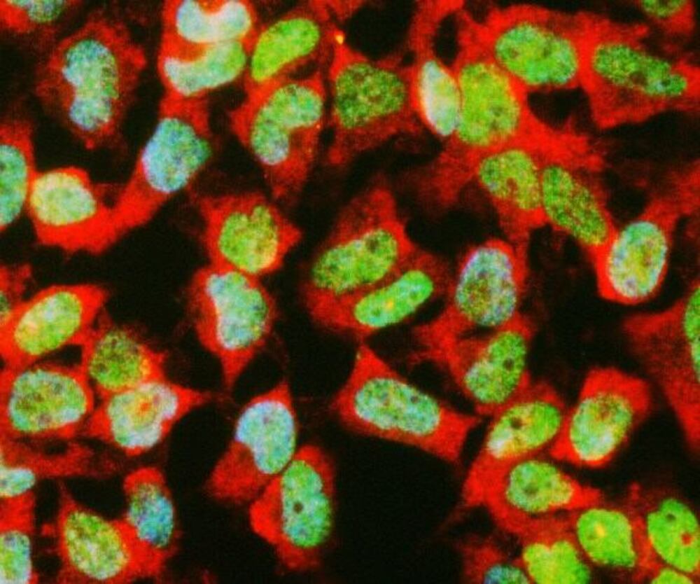 Anti-GAPDH Antibody