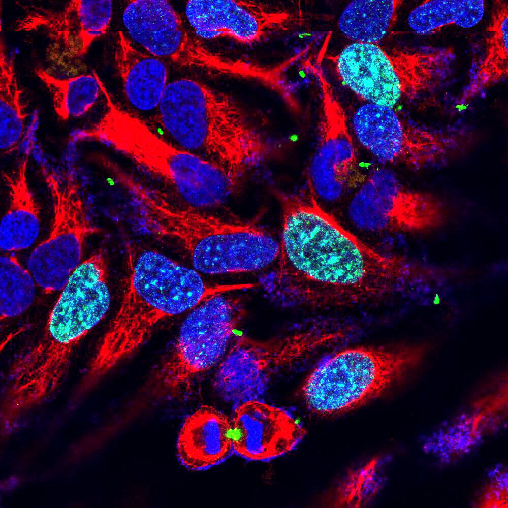 Anti-Aurora B Kinase Antibody [3F11]