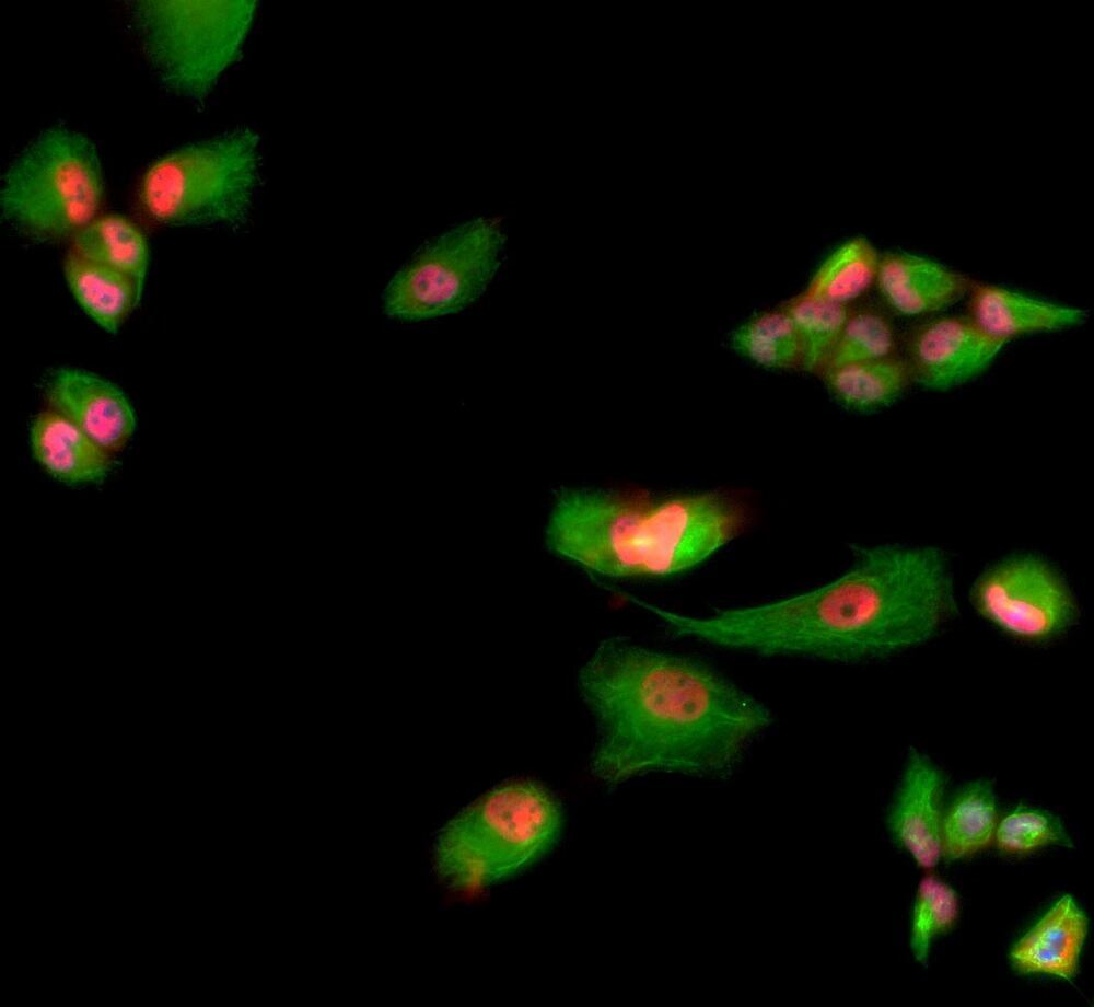 Anti-MBNL1 Antibody [1H1]