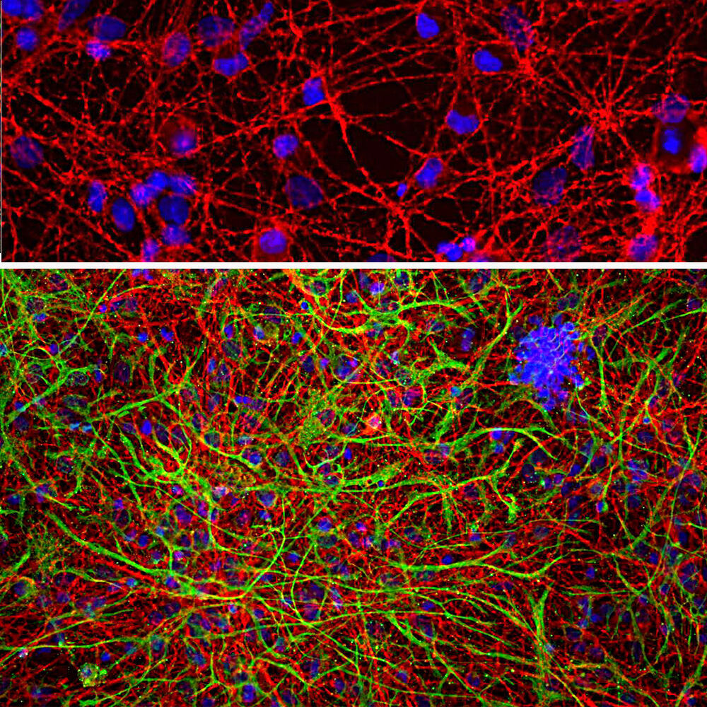 Anti-GAP43 Antibody [5E8]
